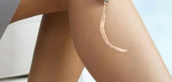 utilisation du gel Vetonus